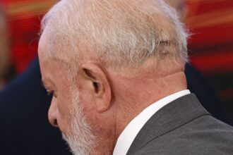 lula-repete-exames-de-imagem-da-cabeca-e-quadro-e-estavel